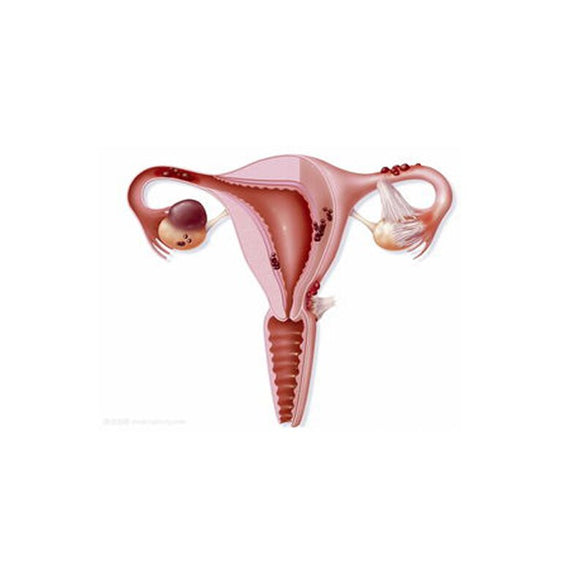 Cartoon Women's womb Pin Brooch Cuterus shape The uterus Brooch Enamel pin Medical Jewelry Feminist gift for Women Doctors Nurse