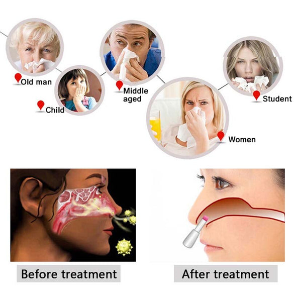 Body Massage Machine Proxy BioNase Nose Rhinitis Sinusitis Cure Therapy Massage Hay fever Low Frequency Pulse Laser Nose Health
